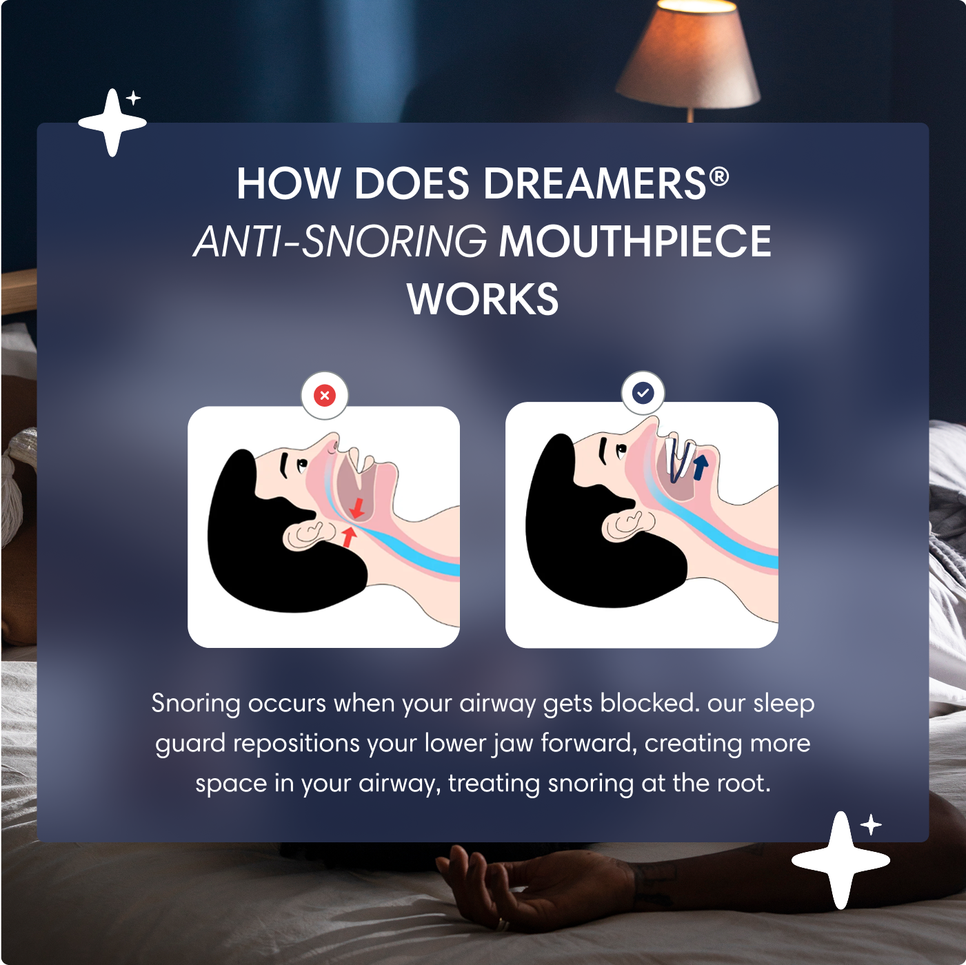 The Dream Cushion® Anti-Snore Mouth Piece