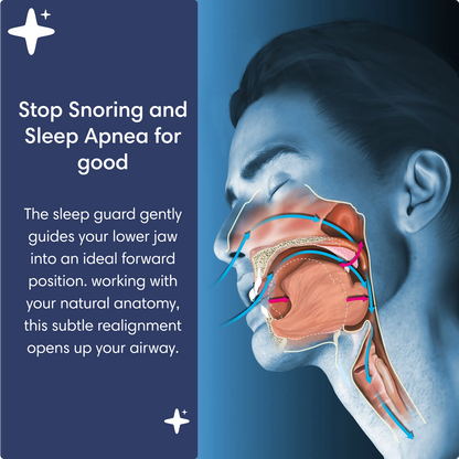 The Dream Cushion® Anti-Snore Mouth Piece